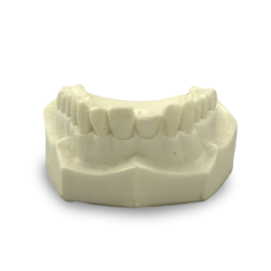 MAXILA COM FRATURA NO DENTE 11 PARA PREPARO - cód. 12232