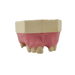 MAXILA COM AUSÊNCIAS PARCIAIS - cód. 12571