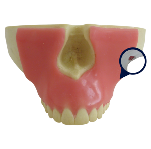 MAXILA COM TODOS OS DENTES, GENGIVA E 3º MOLAR INCLUSO - cód. 4402G-01