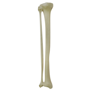 TÍBIA COM CANAL MEDULAR E ESPONJOSO + FÍBULA - ESQUERDA - cód. 2026BESP-1