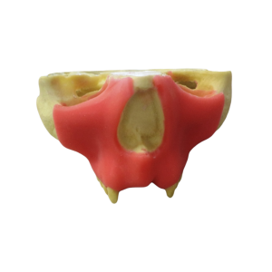 MAXILA COM GENGIVA E AUSÊNCIA DOS DENTES - DENTES 11, 12, 21 E 22 - cód. 9971SGT