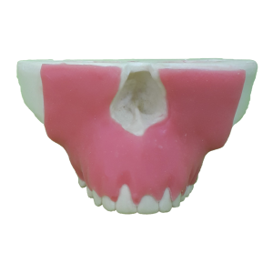 MAXILA COM GENGIVA PERIODONTAL E RECESSÃO - cód. 4051G