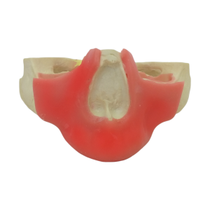 MAXILA EDÊNTULA COM GENGIVA - cód. 4017GT