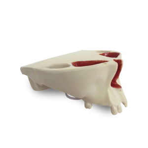 MAXILA COM ALGUNS DENTES - DENTES 12, 16, 17 E 21 - cód. 4014