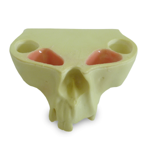 MAXILA COM ALGUNS DENTES - DENTES 12, 16, 17 E 21 - cód. 4015