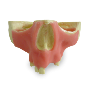 MAXILA COM ALGUNS DENTES E GENGIVA - DENTES 11, 12, 14, 18, 24, 26 e 27 - cód. 4015GT